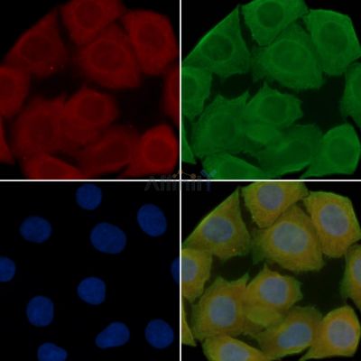 ch TOG Antibody - DF14112 staining Hela cells(30min of UV treatment) by IF/ICC.