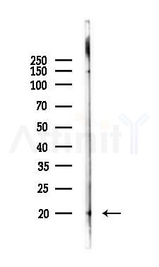 LTC4S Antibody - Western blot analysis of lysates from K562 cells(UV 30min treatment), using LTC4S Antibody at 1/1000 dilution.
