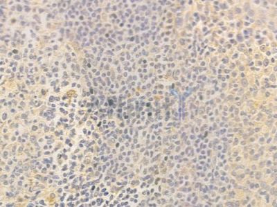MARVELD1 Antibody - DF14131 at 1/100 staining human normal tonsil tissue by IHC-P.