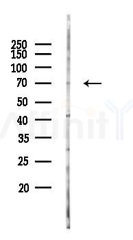 BDP/ARID3B Antibody - Western blot analysis of lysates from COLO205 cells(LPS 4h treatment), using BDP/ARID3B Antibody at 1/1000 dilution.