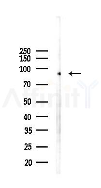 TARSL2 Antibody - Western blot analysis of lysates from B16F10-LUC cells(UV 30min treatment), using TARSL2 Antibody at 1/1000 dilution.