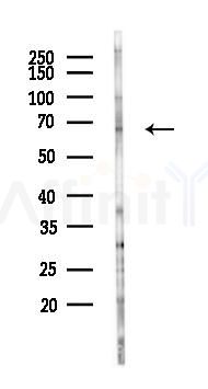 RBM47 Antibody - Western blot analysis of lysates from HUVEC cells(LPS 4h treatment), using RBM47 Antibody at 1/1000 dilution.