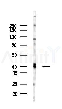 SIAT4A Antibody - Western blot analysis of lysates from HUVEC cells(LPS 4h treatment), using SIAT4A Antibody at 1/1000 dilution.