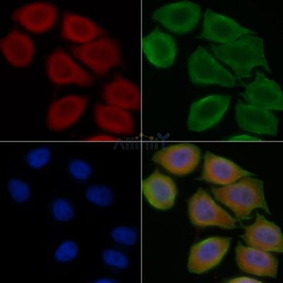 Coatomer subunit delta Antibody - DF14147 staining Hela cells(45min of heat-shock treatment) by IF/ICC.