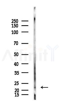 CRYBA4 Antibody - Western blot analysis of lysates from Mouse lung, using CRYBA4 Antibody at 1/1000 dilution.