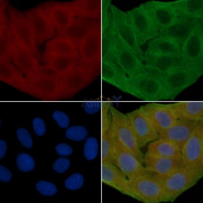 ITM2C Antibody - DF14177 staining Hela cells(30min of UV treatment) by IF/ICC.