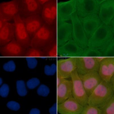 Sohlh2 Antibody - DF14179 staining Hela cells(30min of UV treatment) by IF/ICC.