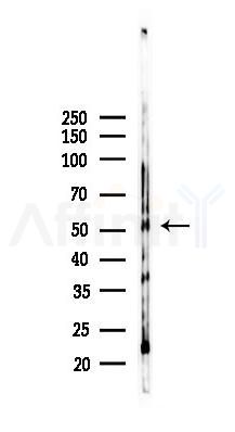 SLC25A23 Antibody - Western blot analysis of lysates from Mouse lung, using SLC25A23 Antibody at 1/1000 dilution.