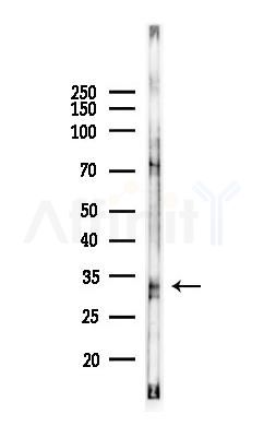 RDH5 Antibody - Western blot analysis of lysates from K562 cells(UV 30min treatment), using RDH5 Antibody at 1/1000 dilution.
