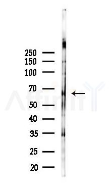 KLHL13 Antibody - Western blot analysis of lysates from Mouse lung, using KLHL13 Antibody at 1/1000 dilution.