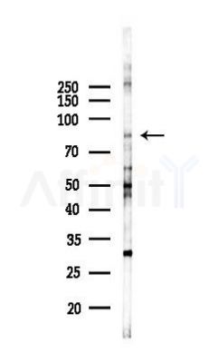DNAJC6 Antibody - Western blot analysis of lysates from K562 cells(UV 30min treatment), using DNAJC6 Antibody at 1/1000 dilution.