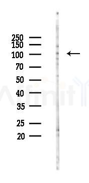 URG4 Antibody - Western blot analysis of lysates from COLO205 cells(LPS 4h treatment), using URG4 Antibody at 1/1000 dilution.