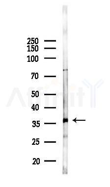 HAUS4 Antibody - Western blot analysis of lysates from K562 cells(UV 30min treatment), using HAUS4 Antibody at 1/1000 dilution.