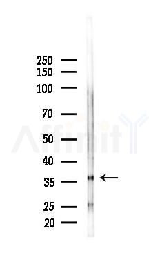 HAUS4 Antibody - Western blot analysis of lysates from Rat liver, using HAUS4 Antibody at 1/1000 dilution.
