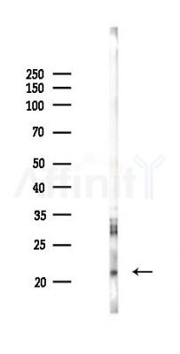 RHOJ Antibody - Western blot analysis of lysates from Rat testis, using RHOJ Antibody at 1/1000 dilution.