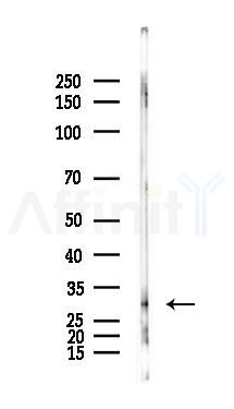 MOX1 Antibody - Western blot analysis of lysates from Mouse brain, using MOX1 Antibody at 1/1000 dilution.