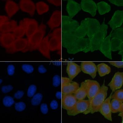 MFSD2A Antibody - DF14210 staining Hela cells(45min of heat-shock treatment) by IF/ICC.