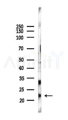 CXXC4 Antibody - Western blot analysis of lysates from K562 cells(UV 30min treatment), using CXXC4 Antibody at 1/1000 dilution.