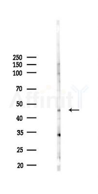 PORCN Antibody - Western blot analysis of lysates from K562 cells(heat-shock 45min treatment), using PORCN Antibody at 1/1000 dilution.