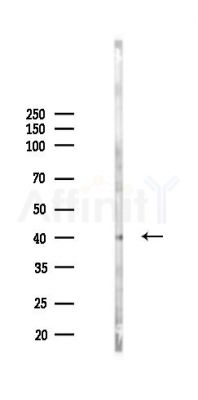RHBDD2 Antibody - Western blot analysis of lysates from K562 cells(heat-shock 45min treatment), using RHBDD2 Antibody at 1/1000 dilution.
