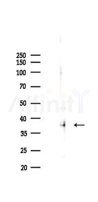 SCARA5 Antibody - Western blot analysis of lysates from B16F10-LUC cells(heat-shock 45min treatment), using SCARA5 Antibody at 1/1000 dilution.
