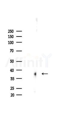 SCARA5 Antibody - Western blot analysis of lysates from Mouse lung, using SCARA5 Antibody at 1/1000 dilution.