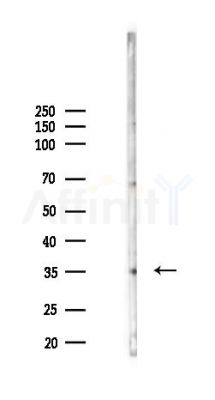 CLDN16 Antibody - Western blot analysis of lysates from K562 cells(heat-shock 45min treatment), using CLDN16 Antibody at 1/1000 dilution.