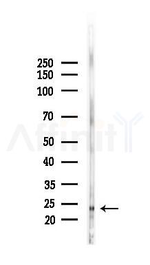 MBD3L2 Antibody - Western blot analysis of lysates from Rat liver, using MBD3L2 Antibody at 1/1000 dilution.