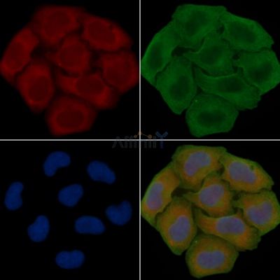 TPTE Antibody - DF14236 staining Hela cells(30min of UV treatment) by IF/ICC.