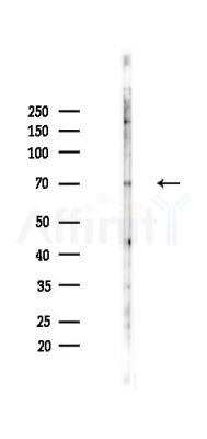 Lgi3 Antibody - Western blot analysis of lysates from Mouse lung, using Lgi3 Antibody at 1/1000 dilution.