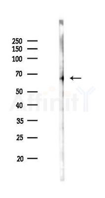 Lgi3 Antibody - Western blot analysis of lysates from Rat testis, using Lgi3 Antibody at 1/1000 dilution.