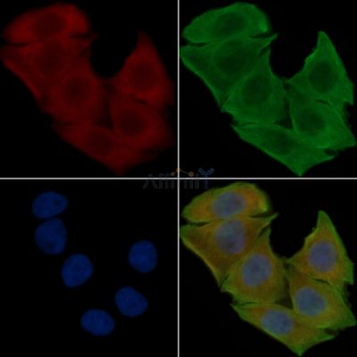 DDT Antibody - DF14248 staining Hela cells(30min of UV treatment) by IF/ICC.