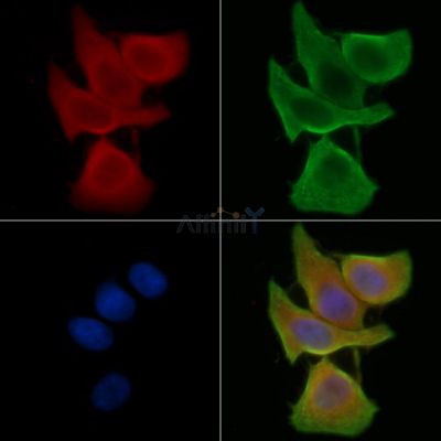 VKORC1L1 Antibody - DF14250 staining Hela cells(45min of heat-shock treatment) by IF/ICC.