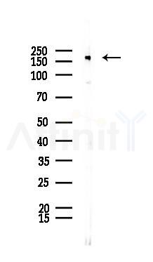 ATAD2 Antibody - Western blot analysis of lysates from K562 cells(UV 30min treatment), using ATAD2 Antibody at 1/1000 dilution.