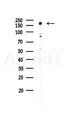 ATAD2 Antibody - Western blot analysis of lysates from EC304 cells(starvation 24h treatment), using ATAD2 Antibody at 1/1000 dilution.