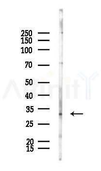 THAP7 Antibody - Western blot analysis of lysates from K562 cells(UV 30min treatment), using THAP7 Antibody at 1/1000 dilution.