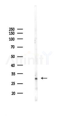 PP11 Antibody - Western blot analysis of lysates from B16F10-LUC cells(heat-shock 45min treatment), using PP11 Antibody at 1/1000 dilution.