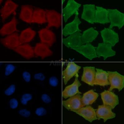 LNP Antibody - DF14257 staining Hela cells(45min of heat-shock treatment) by IF/ICC.