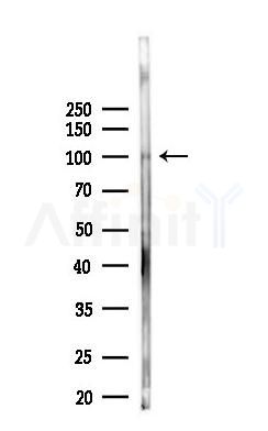 SFMBT2 Antibody - Western blot analysis of lysates from B16F10-LUC cells(UV 30min treatment), using SFMBT2 Antibody at 1/1000 dilution.