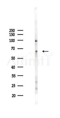 ZKSCAN1 Antibody - Western blot analysis of lysates from B16F10-LUC cells(heat-shock 45min treatment), using ZKSCAN1 Antibody at 1/1000 dilution.