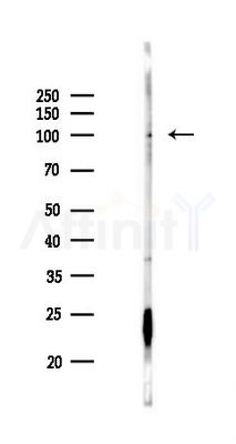OSBPL5 Antibody - Western blot analysis of lysates from Rat testis, using OSBPL5 Antibody at 1/1000 dilution.