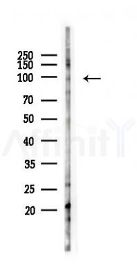 SGEF Antibody - Western blot analysis of lysates from PC12 cells(LPS 4h treatment), using SGEF Antibody at 1/1000 dilution.