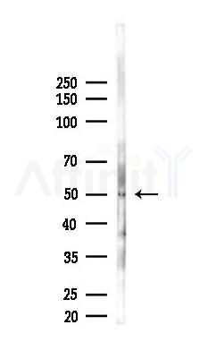 RPL3L Antibody - Western blot analysis of lysates from EC304 cells(starvation 24h treatment), using RPL3L Antibody at 1/1000 dilution.
