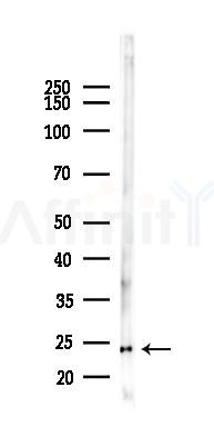 TP53INP2 Antibody - Western blot analysis of lysates from Rat testis, using TP53INP2 Antibody at 1/1000 dilution.