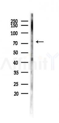 PIGO Antibody - Western blot analysis of lysates from HUVEC cells(LPS 4h treatment), using PIGO Antibody at 1/1000 dilution.
