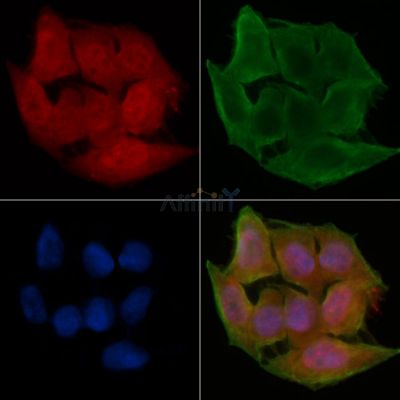Dystrobrevin beta Antibody - DF14336 staining Hela cells(45min of heat-shock treatment) by IF/ICC.