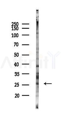 SPC24 Antibody - Western blot analysis of lysates from EC304 cells(heat-shock 45min treatment), using SPC24 Antibody at 1/1000 dilution.
