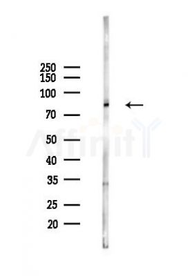 Transglutaminase 7 Antibody - Western blot analysis of lysates from Rat brain, using Transglutaminase 7 Antibody at 1/1000 dilution.