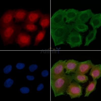 TRAM1 Antibody - DF14371 staining Hela cells(30min of UV treatment) by IF/ICC.