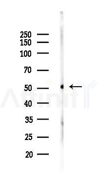 Glucose Transporter 8 Antibody - Western blot analysis of lysates from Rat liver, using Glucose Transporter 8 Antibody at 1/1000 dilution.